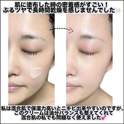 レッドブレミッシュ クリアスージングクリーム/Dr.G/フェイスクリームを使ったクチコミ(4枚目)