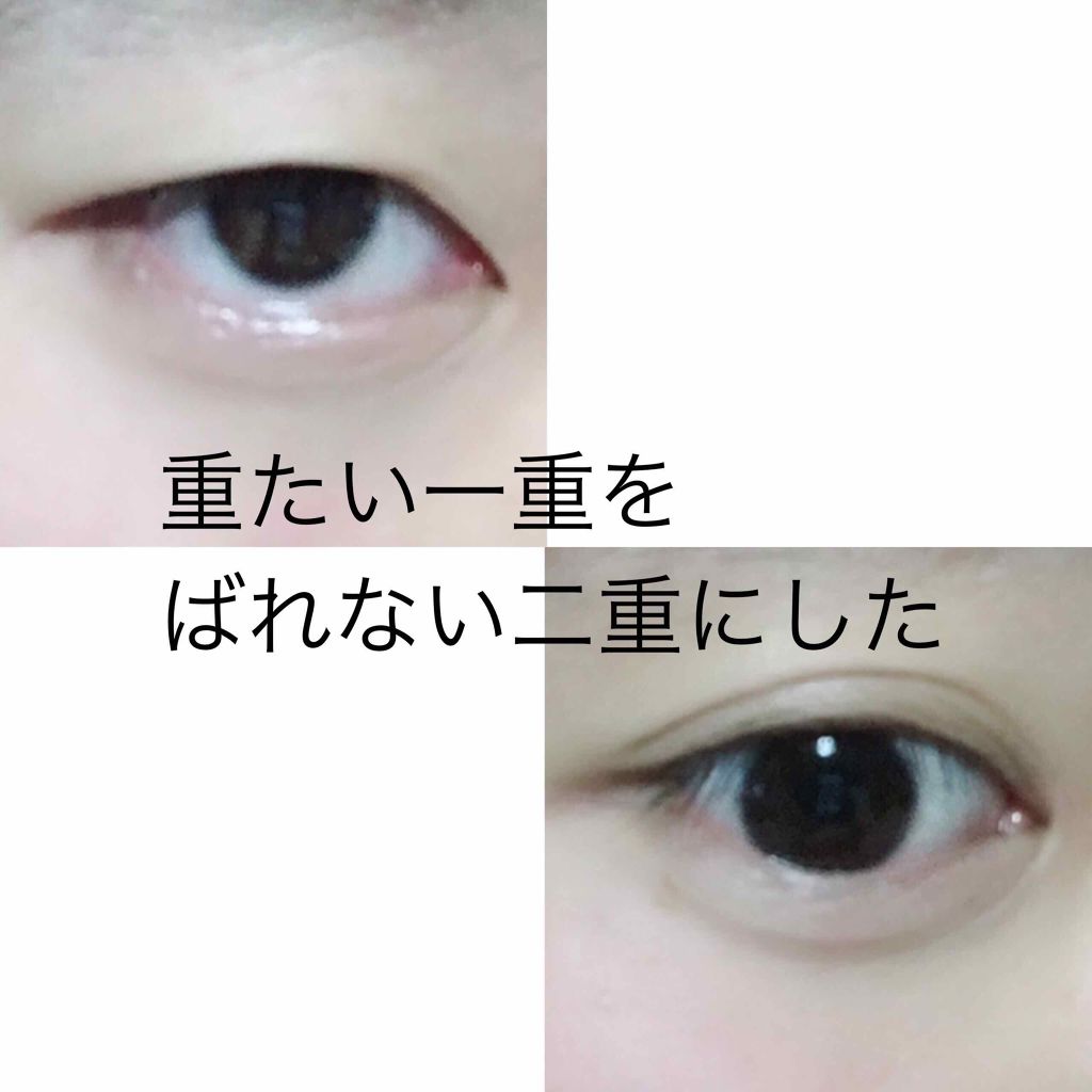 アイトーク/アイトーク/二重まぶた用アイテムを使ったクチコミ(1枚目)