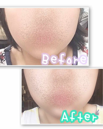 オーロラ ゴールドアンプルシグネチャー/クレイジーモンキー/フェイスクリームを使ったクチコミ(2枚目)