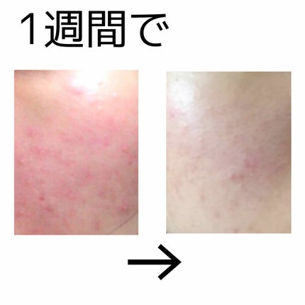 アロエ99% スージングジェル/HOLIKA HOLIKA/ボディローションを使ったクチコミ(2枚目)