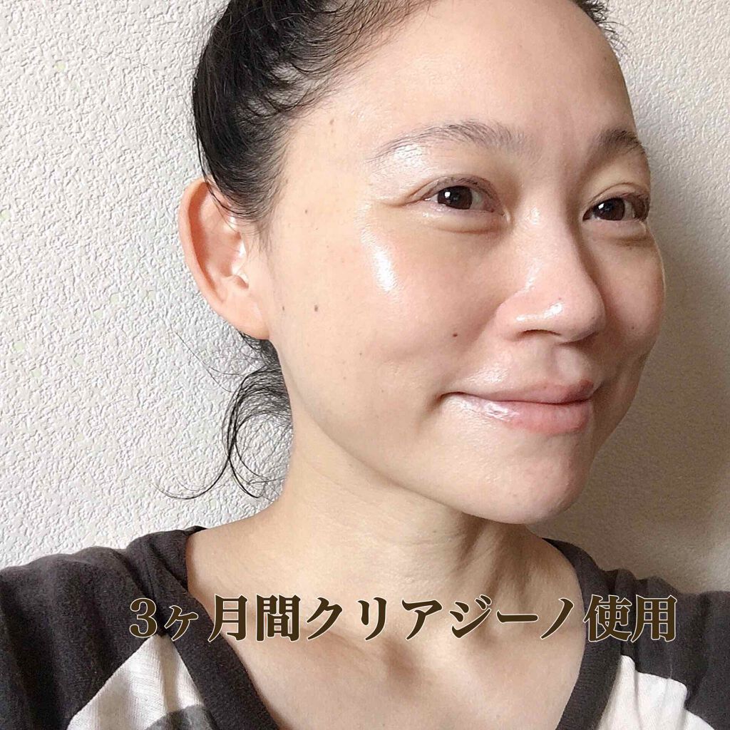 梅ちゃんアラフィフツヤ肌オタク on LIPS 「𓅪𓂃𓈒𓏸クリアジーノを使用して3ヶ月がたちました.@cle..」(5枚目)