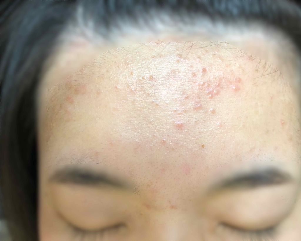 シカ クリーム/Lovelycos /フェイスクリームを使ったクチコミ（3枚目）