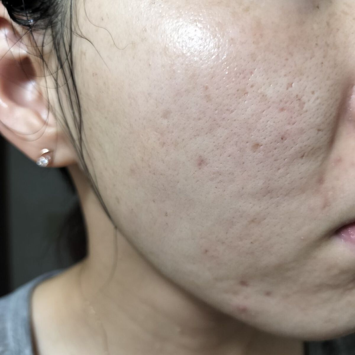 レチノールA 1% アドバンスドリバイタリゼーションクリーム/Life-flo/フェイスクリームを使ったクチコミ（1枚目）