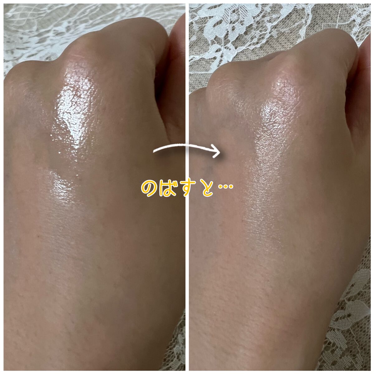 薬用しみ集中対策 プレミアム美容液/メラノCC/美容液を使ったクチコミ(4枚目)