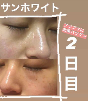 サンホワイトp 1 サンホワイトの口コミ サンホワイトを使って2日目 By ミカコ 乾燥肌 代前半 Lips サンホワイトp 1 サンホワイトの口コミ サンホワイトを使って2日目 By ミカコ 乾燥肌 代前半 Lips