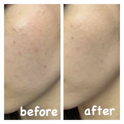 カラーステイ メイクアップ/REVLON/リキッドファンデーションを使ったクチコミ(1枚目)