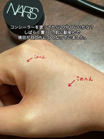 ソフトマットコンプリートコンシーラー/NARS/クリームコンシーラーを使ったクチコミ(6枚目)