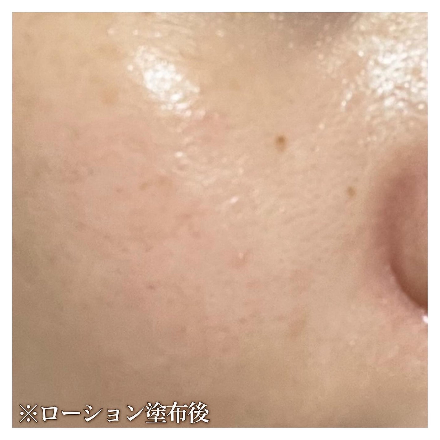 モイスチャーローション/プロメディアル/化粧水を使ったクチコミ(5枚目)