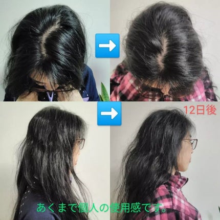 女性用育毛剤 puro fiore/CLOTHASSIS/頭皮ローションを使ったクチコミ(2枚目)