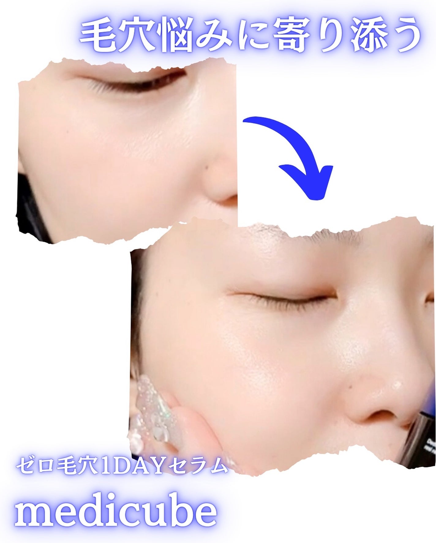 ゼロ毛穴1DAYセラム/MEDICUBE/美容液を使ったクチコミ(3枚目)