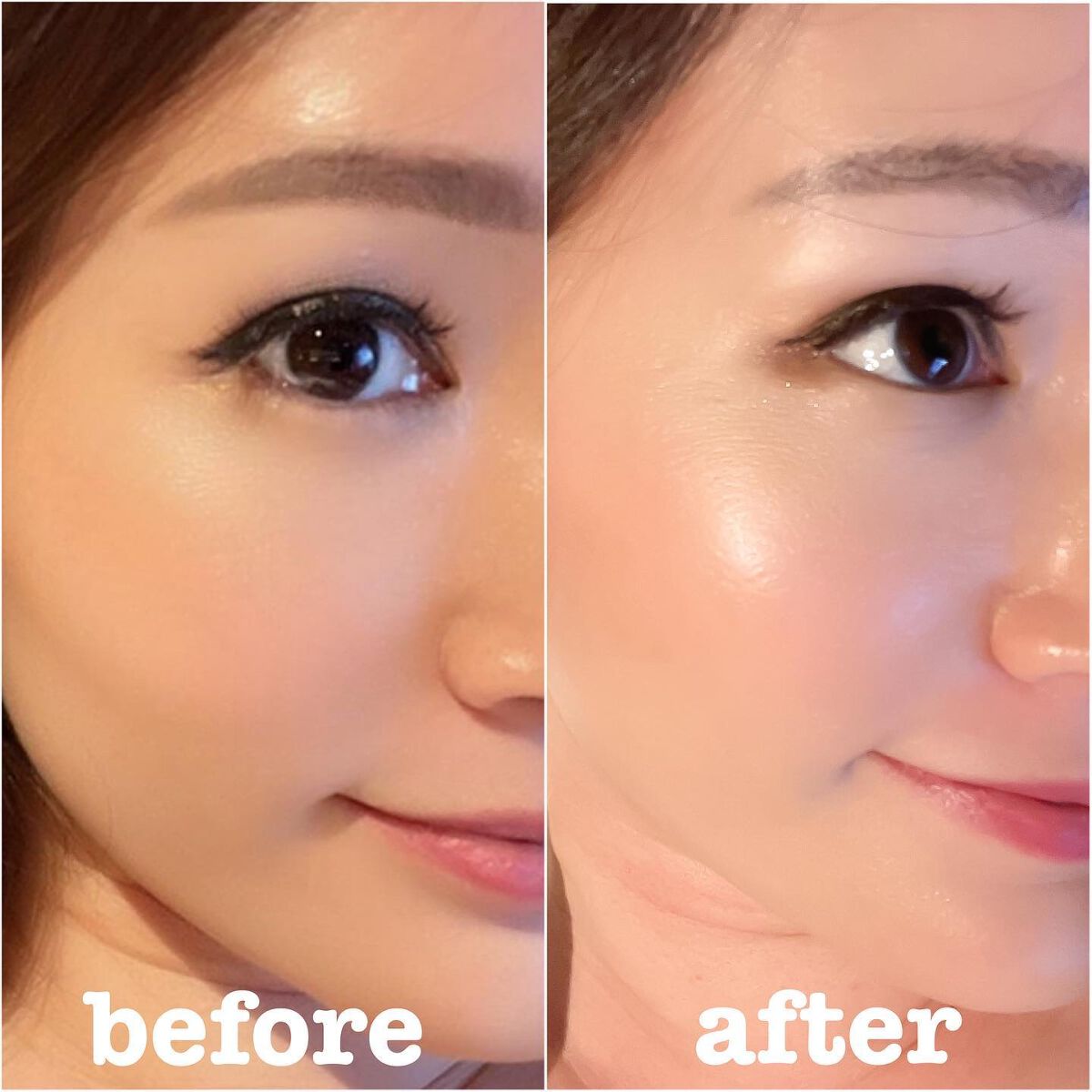 スノーセル/メディタミン/美容サプリメントを使ったクチコミ（3枚目）