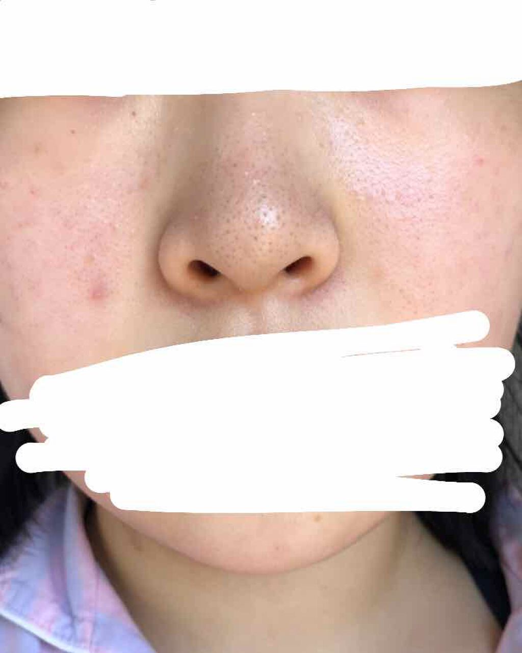 ハトムギ化粧水(ナチュリエ スキンコンディショナー R )/ナチュリエ/化粧水を使ったクチコミ(2枚目)