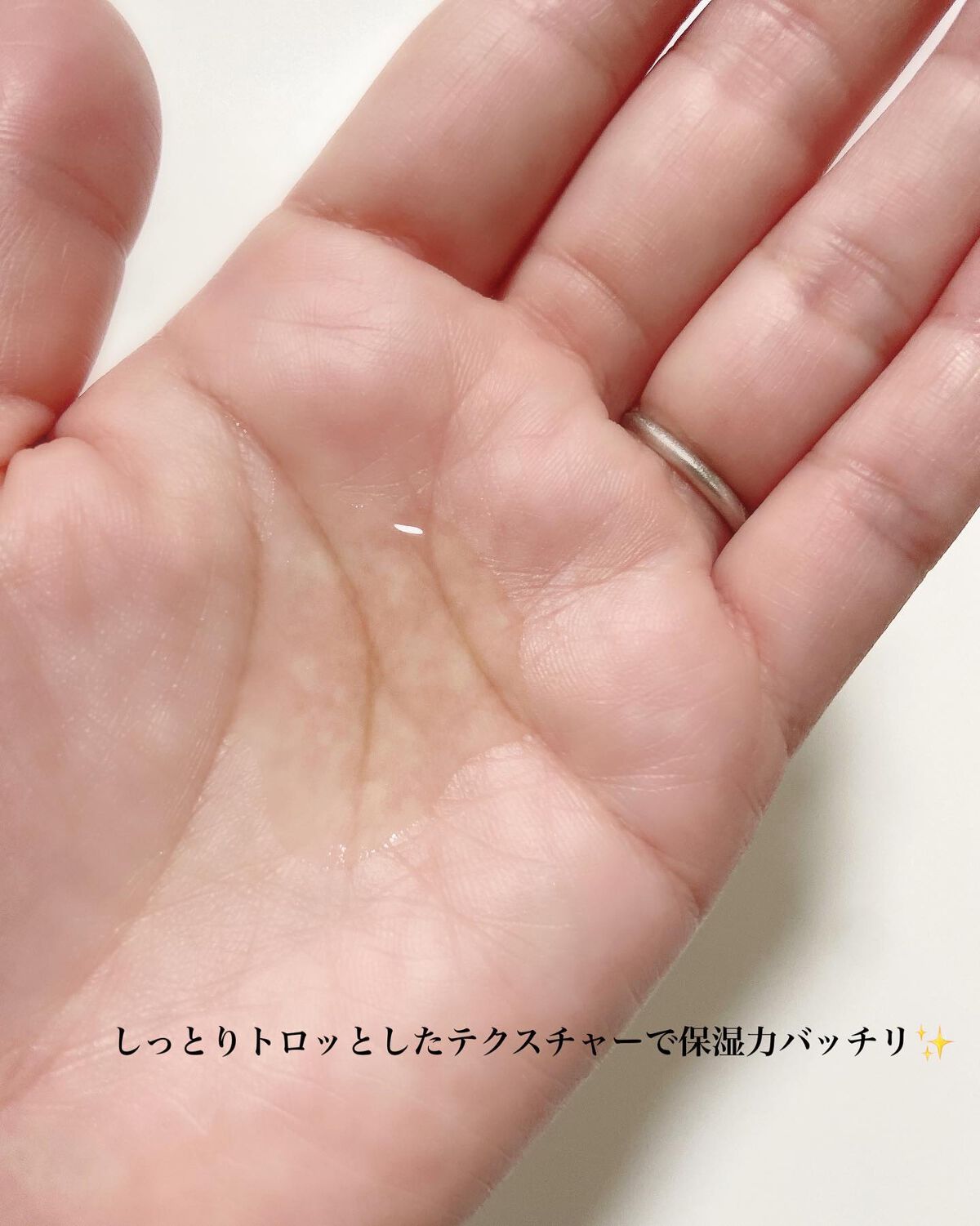 フルフィットプロポリスシナジートナー/COSRX/化粧水を使ったクチコミ(4枚目)