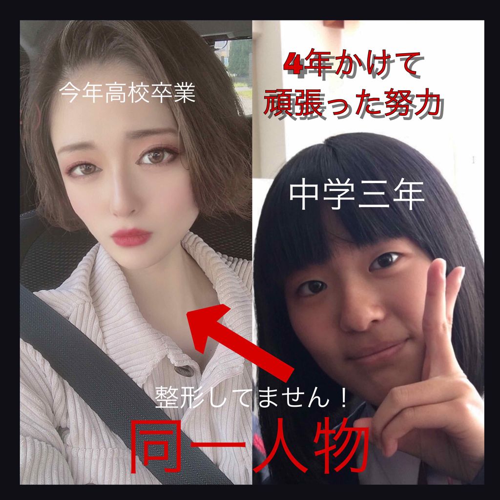 イースト×エンザイムダイエット/メタボリック/ボディサプリメントを使ったクチコミ（1枚目）