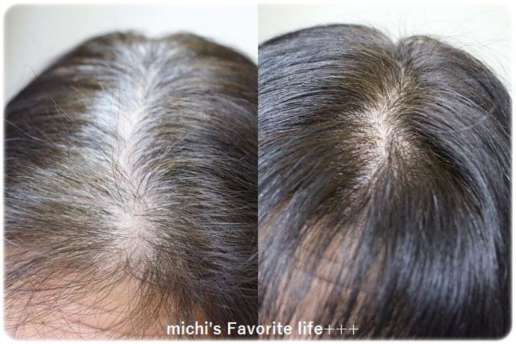 エクセランス R クリームタイプ /ロレアル パリ/ヘアカラーを使ったクチコミ(4枚目)