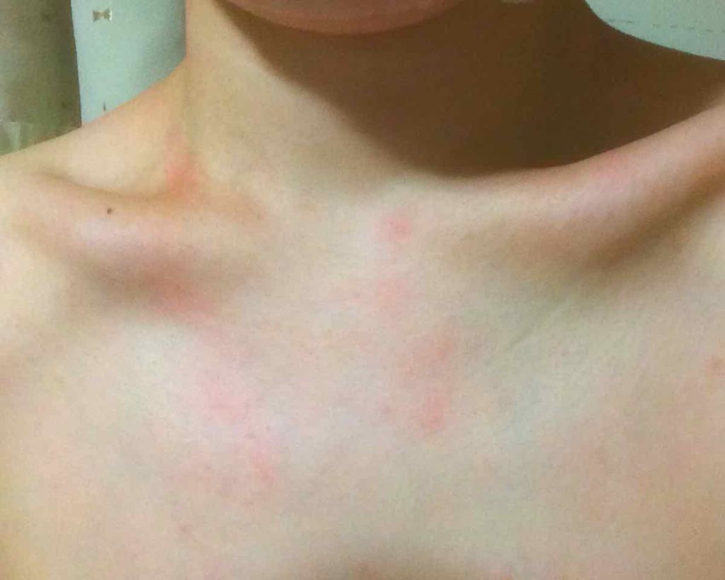 アフターサンウォータージェル/SUNBATH/ボディクリームを使ったクチコミ(3枚目)