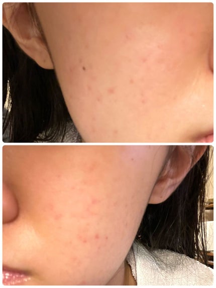 白潤プレミアム薬用浸透美白化粧水/肌ラボ/化粧水を使ったクチコミ(2枚目)