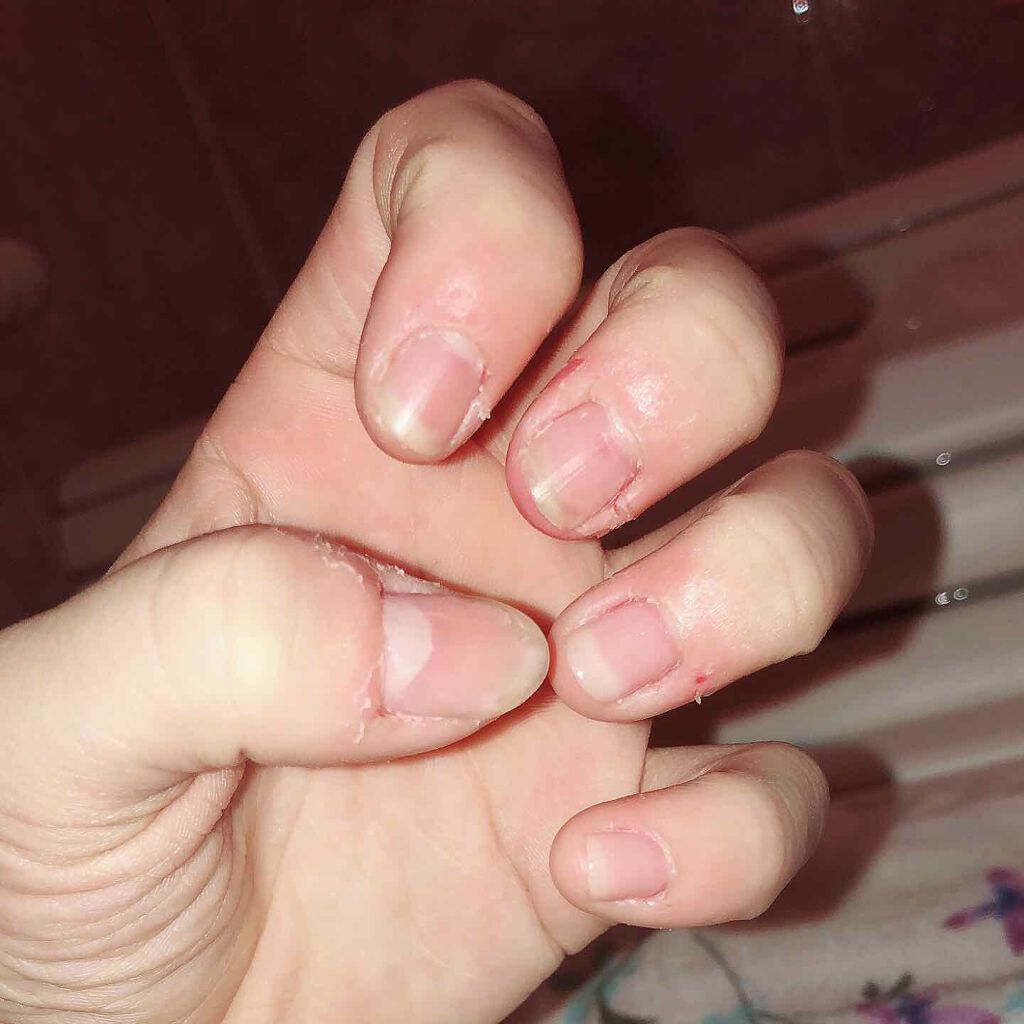 ネイルファンデーション/パラドゥ/マニキュアを使ったクチコミ（2枚目）