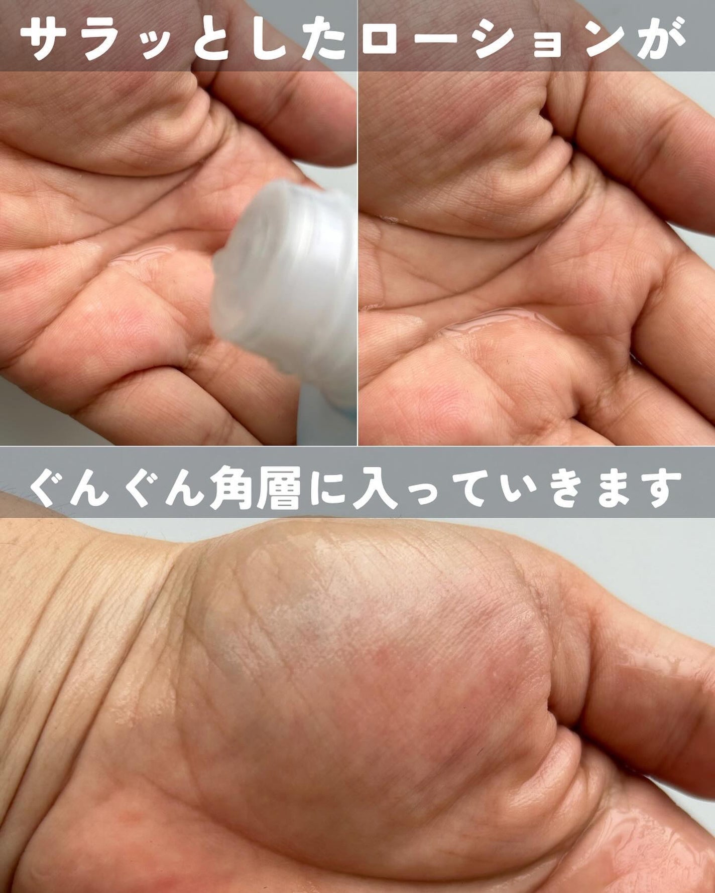 モイストバランス ローション/ACSEINE/化粧水を使ったクチコミ(6枚目)