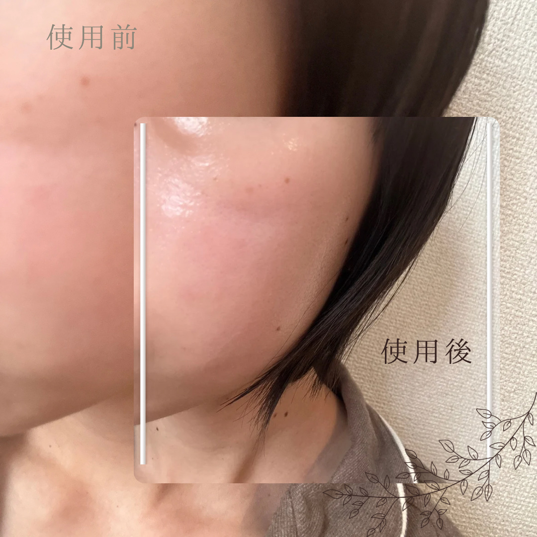 エクソソームシカ アンプル/MEDICUBE/美容液を使ったクチコミ（3枚目）