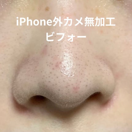 アンチポアブラックヘッドパーフェクトクリアキット/CNP Laboratory/シートマスク・パックを使ったクチコミ(2枚目)