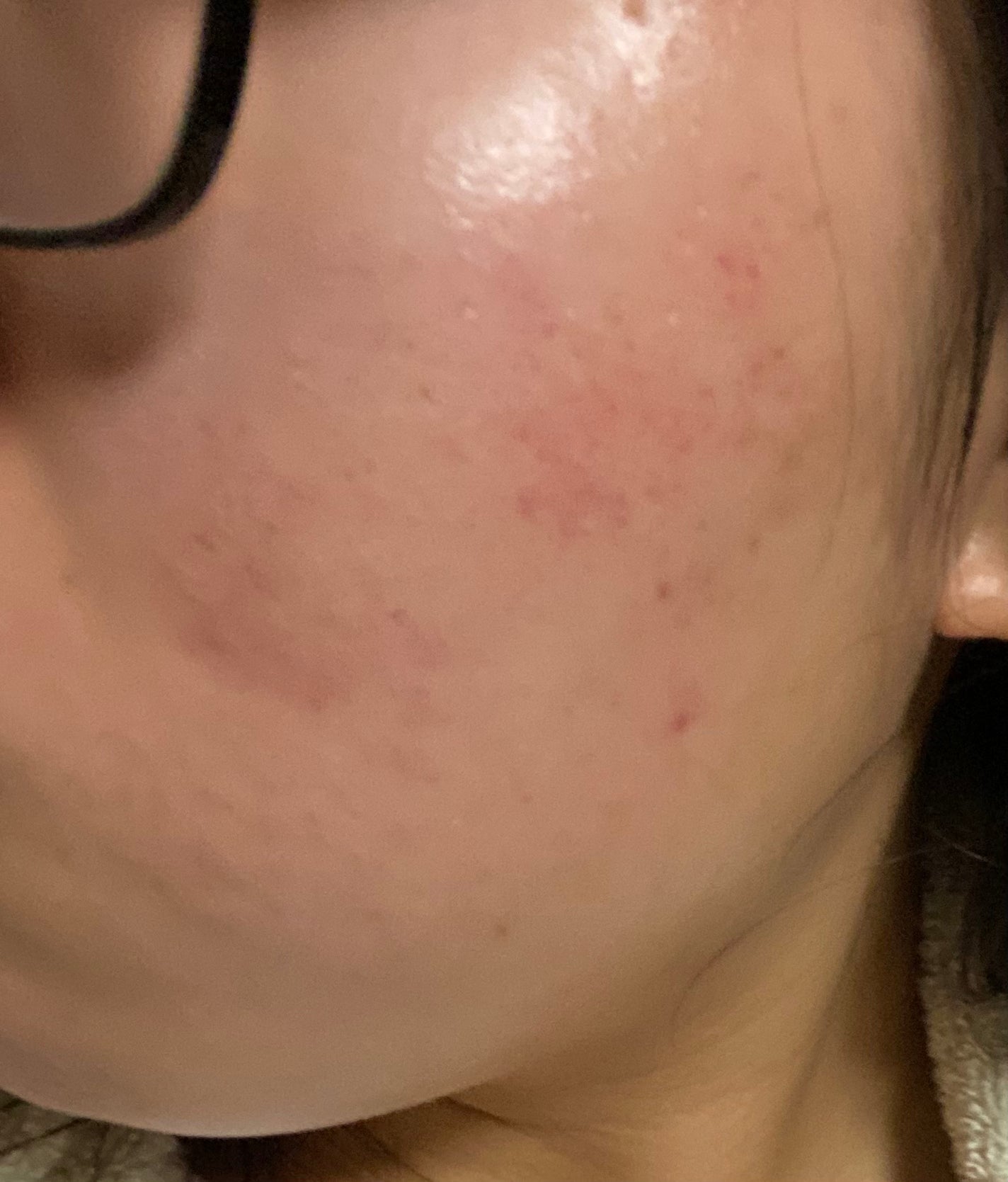 薬用しみ集中対策 プレミアム美容液/メラノCC/美容液を使ったクチコミ(2枚目)