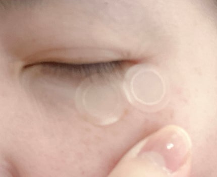 エーキュアショットスポットパッチ/obsero/にきびパッチを使ったクチコミ(2枚目)