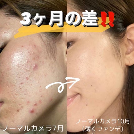 TK クレンジングクリーム/メナード/クレンジングクリームを使ったクチコミ(1枚目)