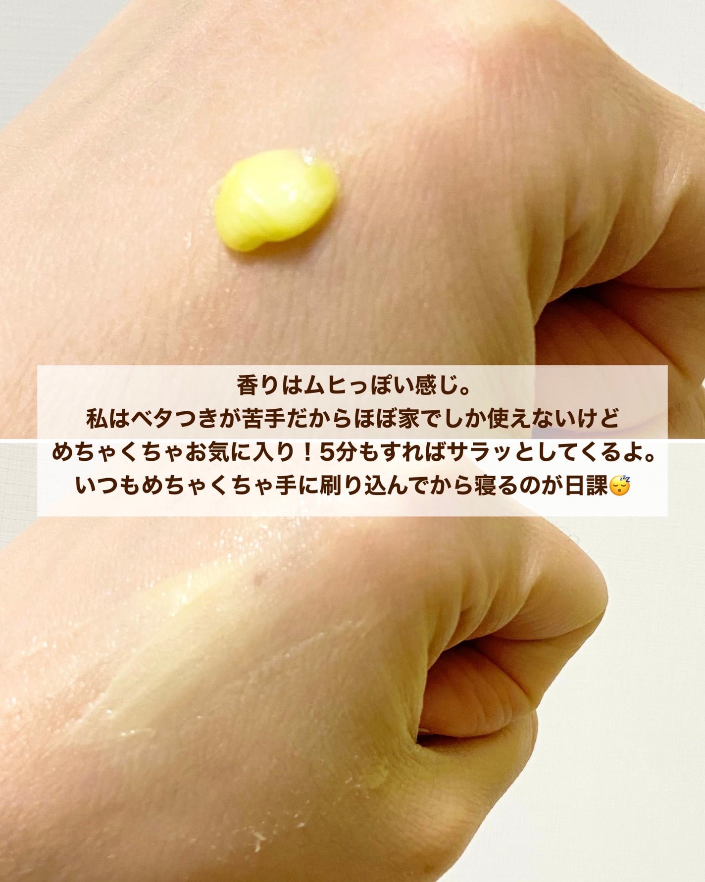 ユースキン/ユースキン/ボディクリームを使ったクチコミ(4枚目)