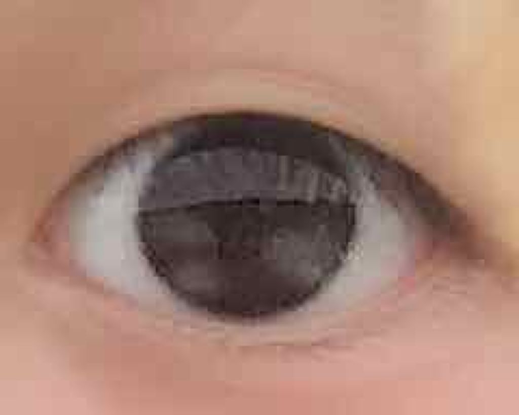 のびーるアイテープ（絆創膏タイプ、レギュラー）/DAISO/二重まぶた用アイテムを使ったクチコミ（3枚目）