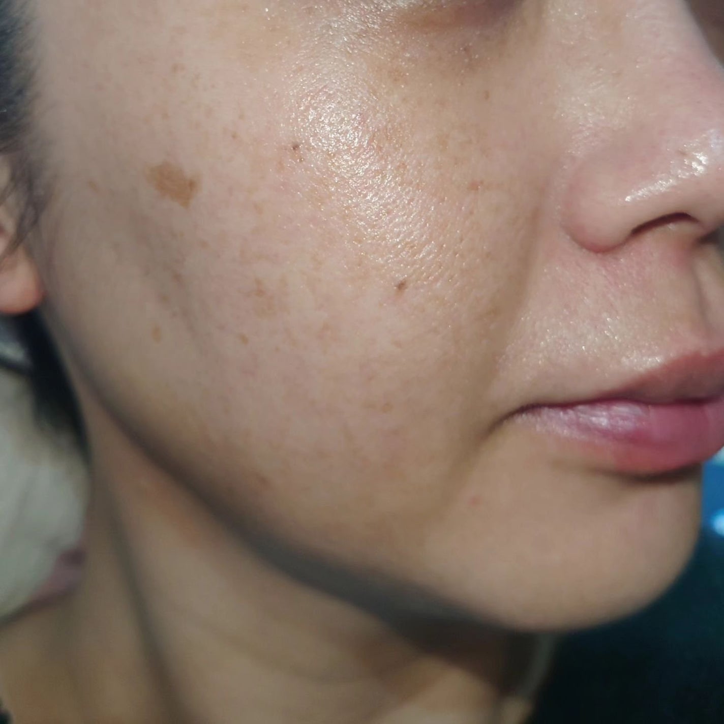 レチノール スーパーバウンス セラム/IOPE/美容液を使ったクチコミ(3枚目)