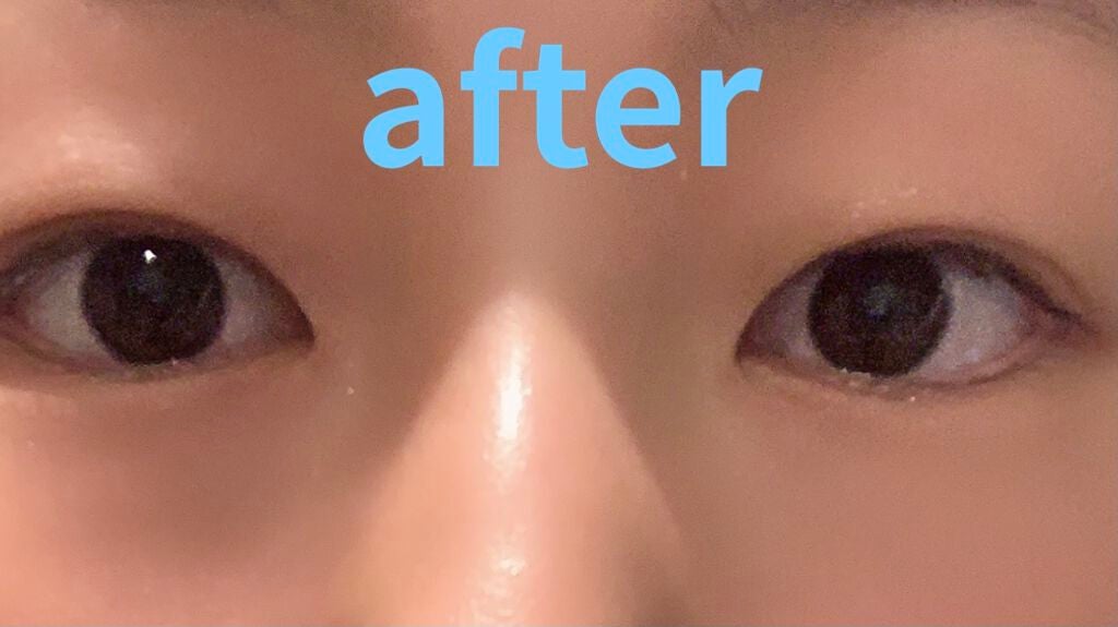 オリジナル ピュアスキンジェリー/ヴァセリン/ボディクリームを使ったクチコミ(3枚目)