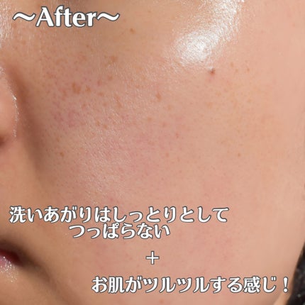 カロテンIPMP(TM) とろけるクレンジングバーム /APRILSKIN/クレンジングバームを使ったクチコミ(10枚目)