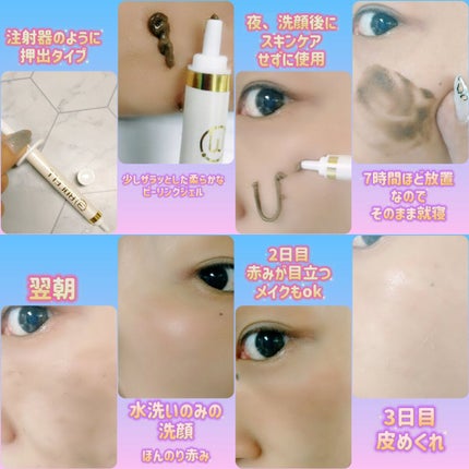 ダーマスキンピーリング/BQCELL/その他キットセットを使ったクチコミ(2枚目)