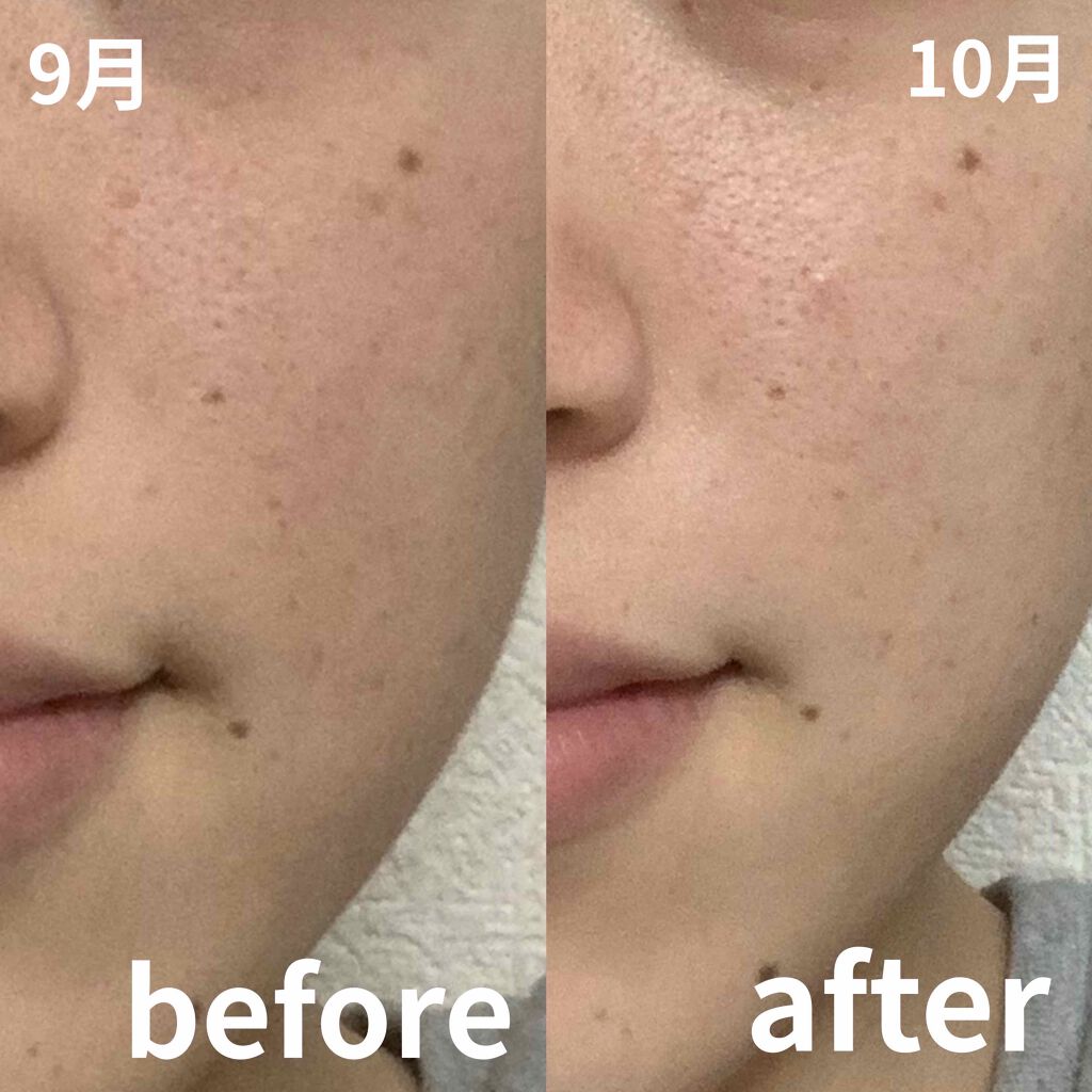 ハトムギ化粧水(ナチュリエ スキンコンディショナー R )/ナチュリエ/化粧水を使ったクチコミ(2枚目)