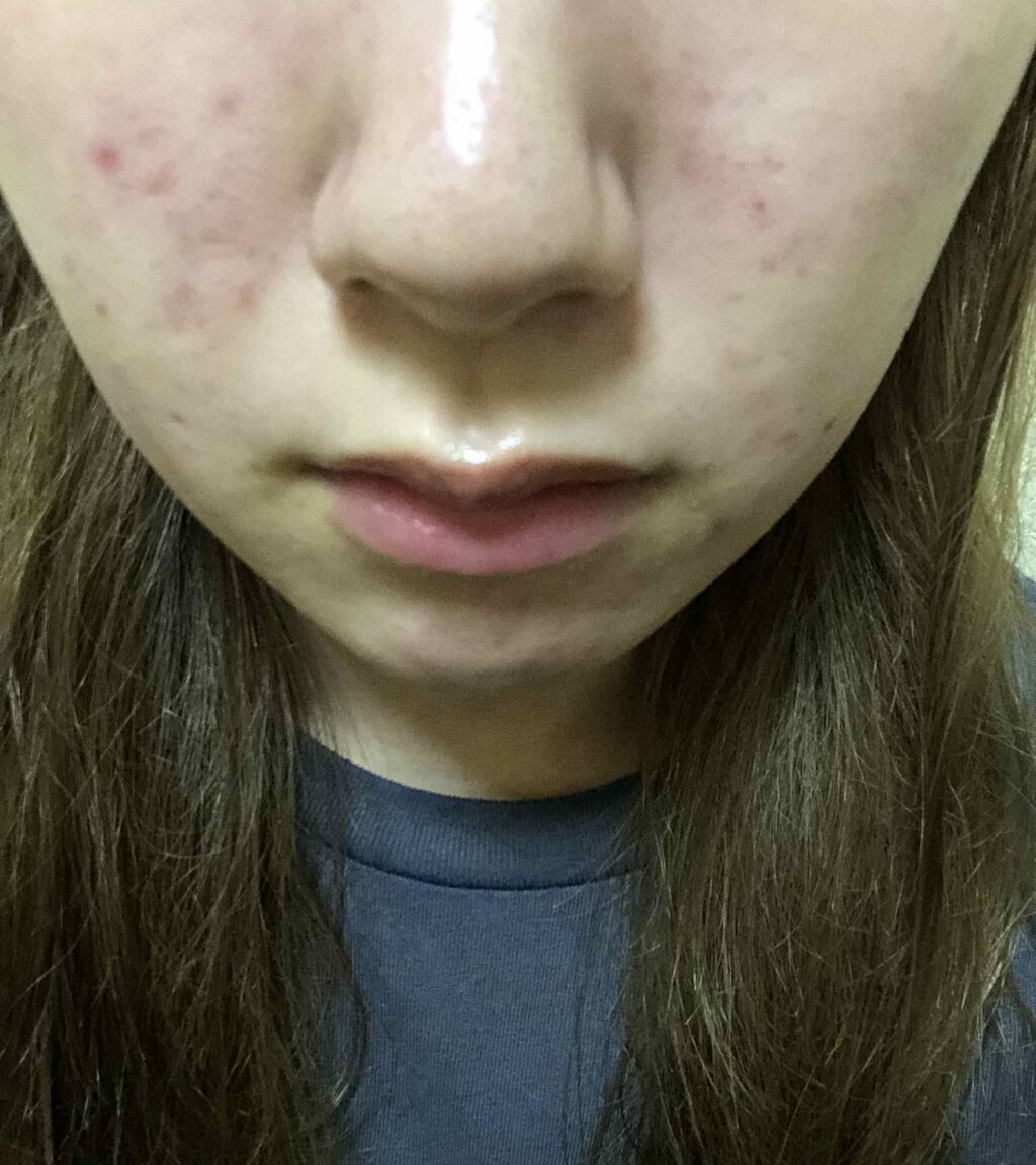 ハトムギ保湿ジェル(ナチュリエ スキンコンディショニングジェル)/ナチュリエ/美容液を使ったクチコミ（2枚目）