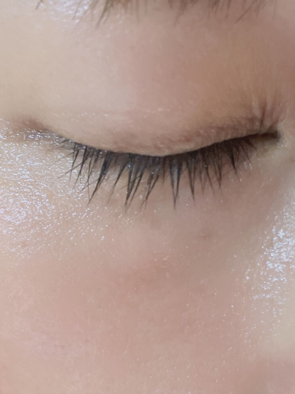 プリスクリードi（医薬品）/IHADA/その他を使ったクチコミ（3枚目）