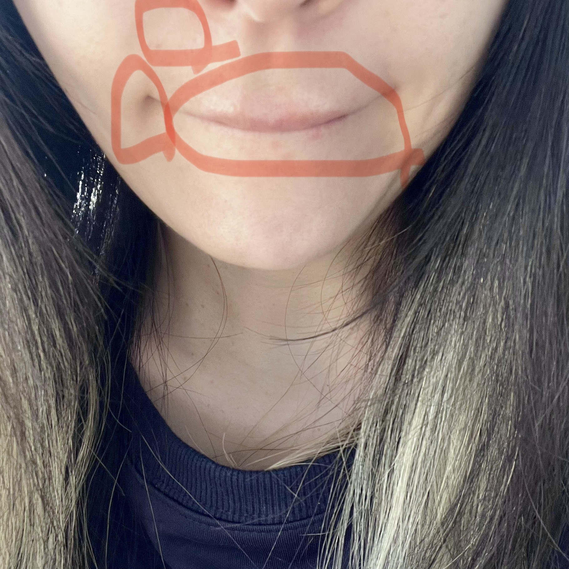 プリスクリードD(医薬品)/IHADA/その他を使ったクチコミ（3枚目）