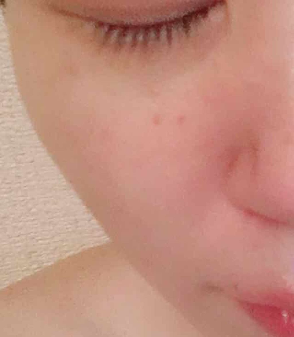 クレンジングミルク/RF28/ミルククレンジングを使ったクチコミ(2枚目)