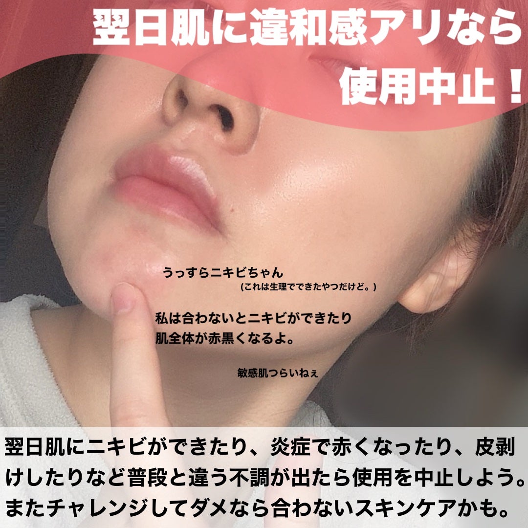 トリートメント クレンジング ミルク/COVERMARK/ミルククレンジングを使ったクチコミ(6枚目)