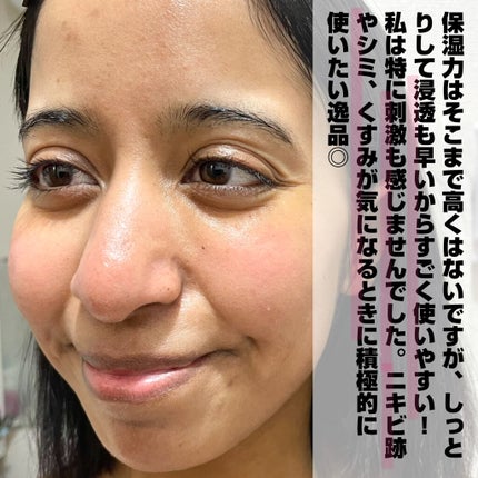 ビタミンACEセラム/APRILSKIN/美容液を使ったクチコミ(5枚目)