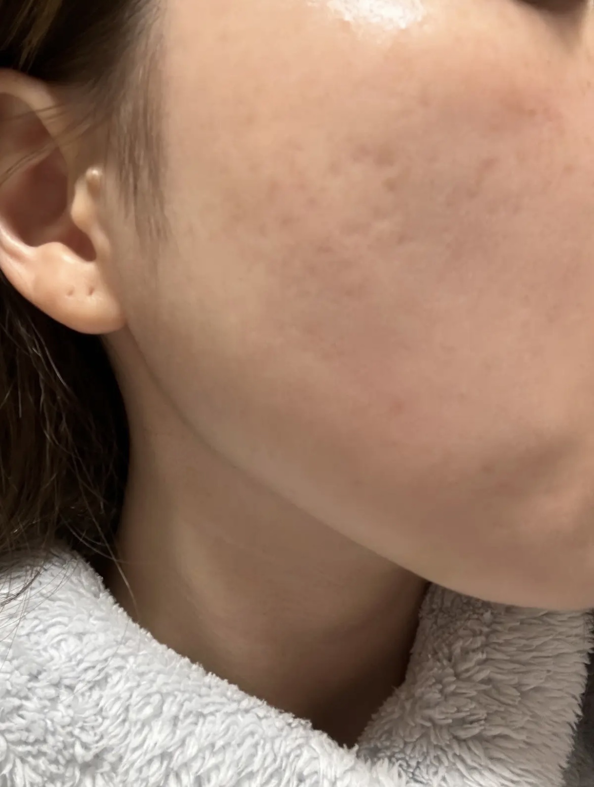 LA10+HAフェイスセラム/The Ordinary/ピーリングを使ったクチコミ（1枚目）