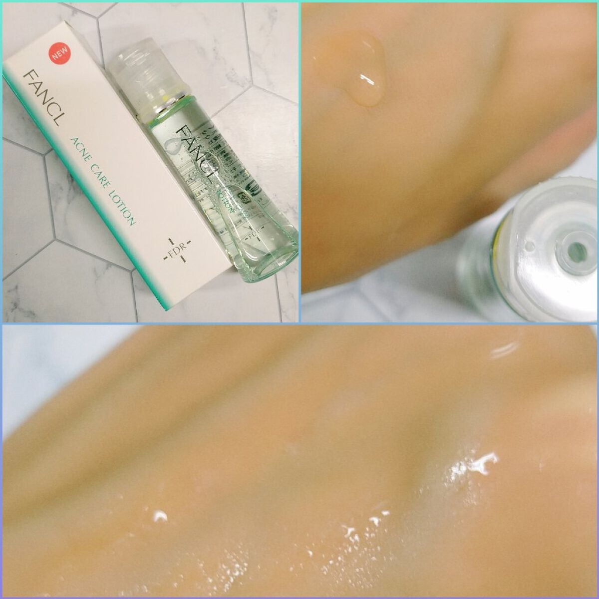FDR アクネケア 化粧液/ファンケル/化粧水を使ったクチコミ(2枚目)
