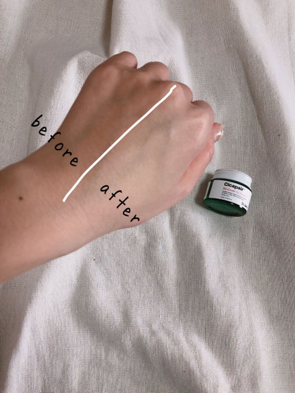 ドクタージャルト シカペア リカバー (第2世代)/Dr.Jart+/フェイスクリームを使ったクチコミ(4枚目)