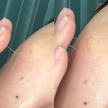 ピンクアロエムチンセラム/APRILSKIN/美容液を使ったクチコミ(5枚目)