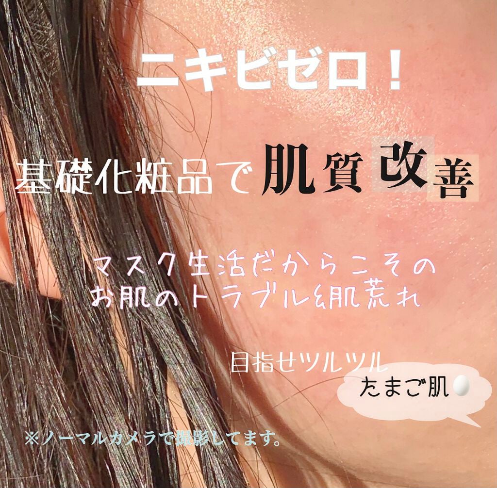 潤浸保湿 化粧水 III とてもしっとり/キュレル/化粧水を使ったクチコミ(1枚目)