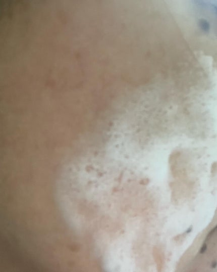 フェイシャルウォッシュフォーム(しっとり)/セバメド/洗顔フォームを使ったクチコミ(3枚目)