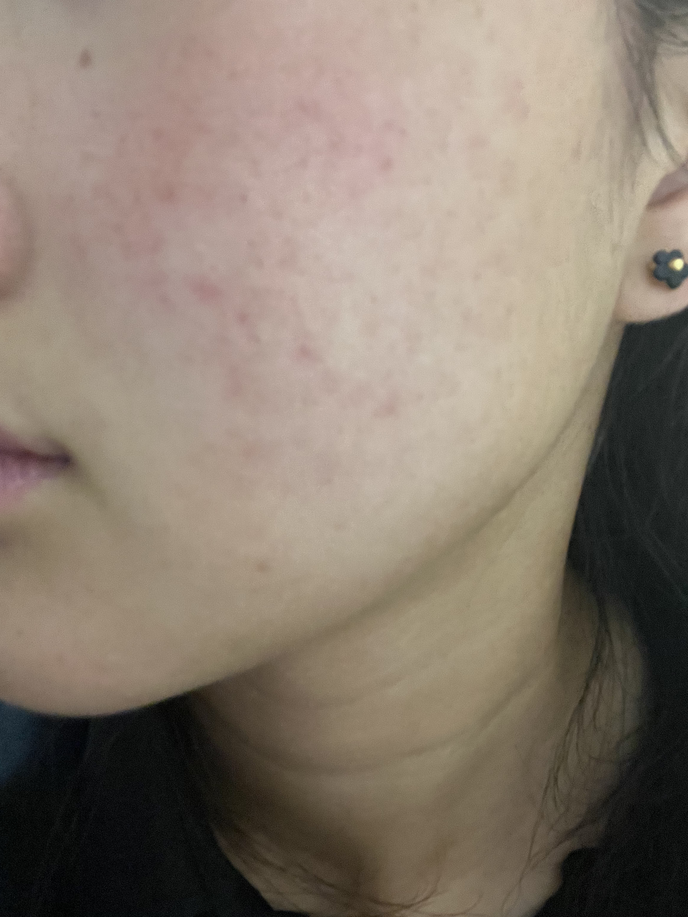 発酵導入化粧液/無印良品/化粧水を使ったクチコミ（1枚目）