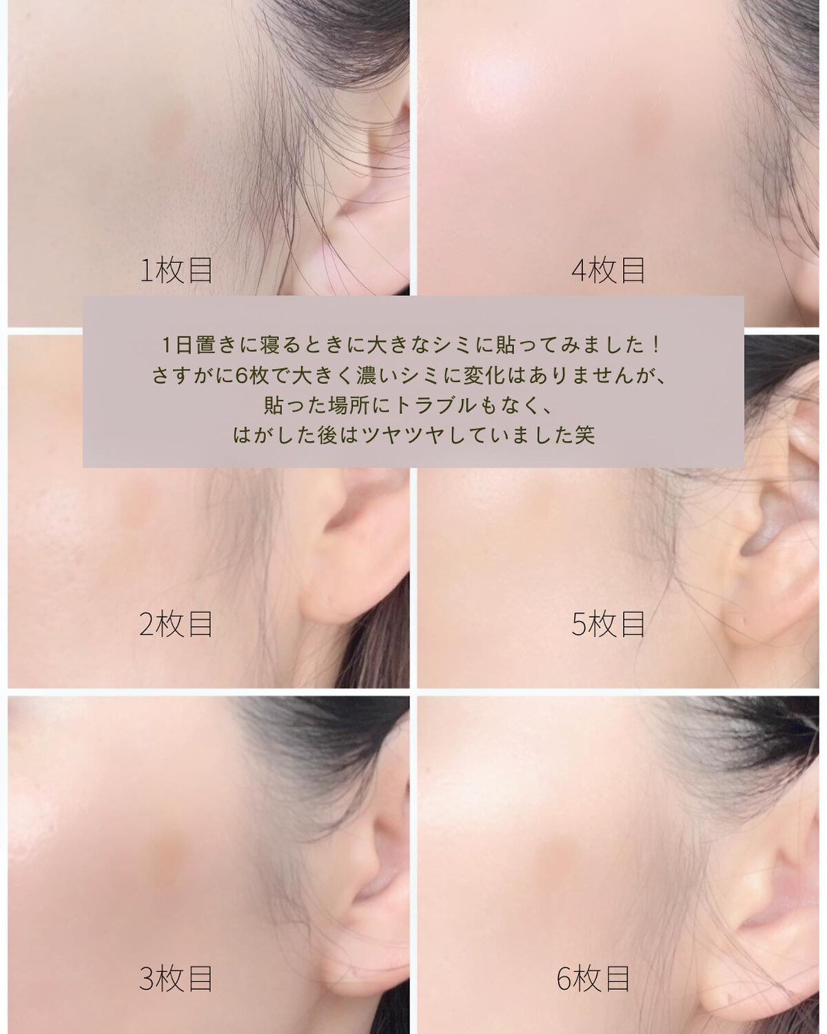 ディープビタCパッチ/MEDICUBE/その他スキンケアを使ったクチコミ(5枚目)