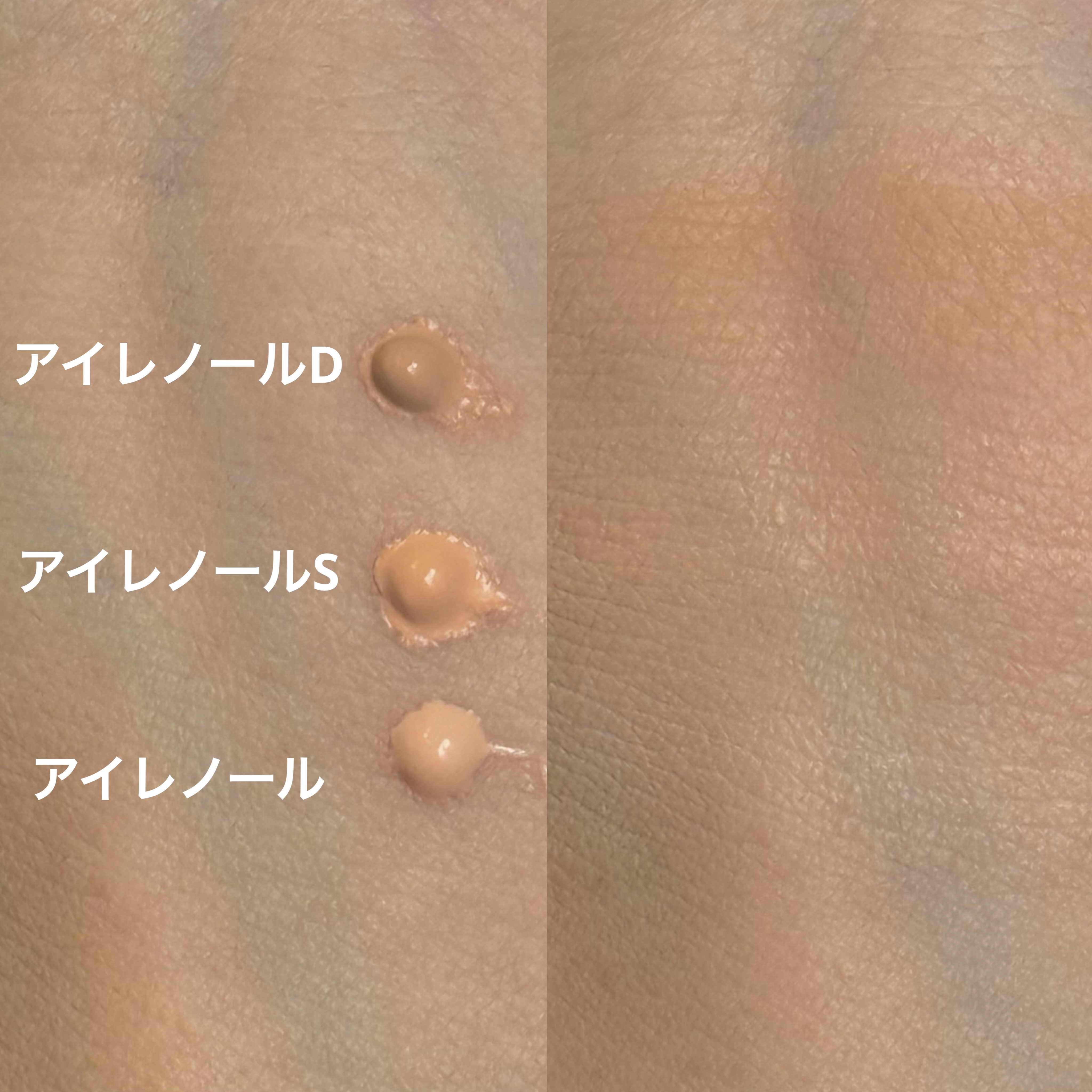 アイレノール クマクリーム/IRENOL/アイケア・アイクリームを使ったクチコミ（2枚目）